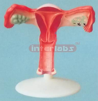 BIG MAGNIFIED UTERUS OBVERSE DISSECT (A TYPE)